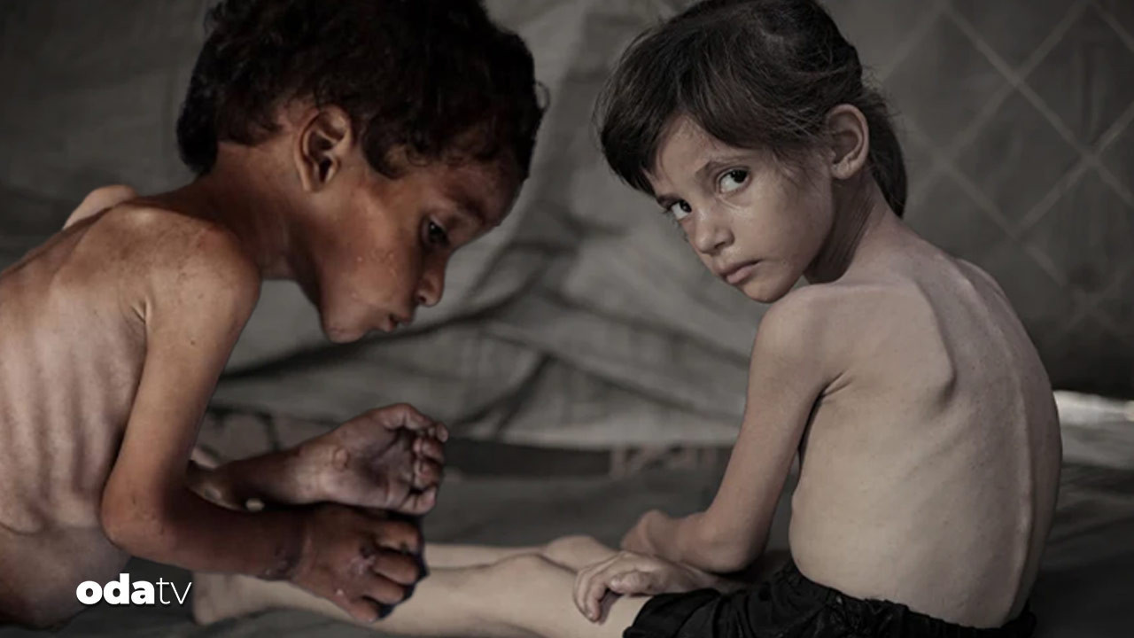 new york times daha fazla dayanamadi gazzede cocuklar acliktan eriyor hayatta kalanlarin gelecegi tehlikede 1I6Dlec4