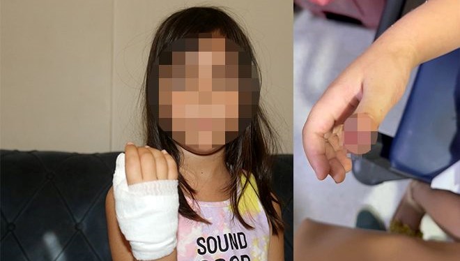 anaokulunda korkunc olay dort yasindaki cocugun parmagi koptu X7VUPwJs